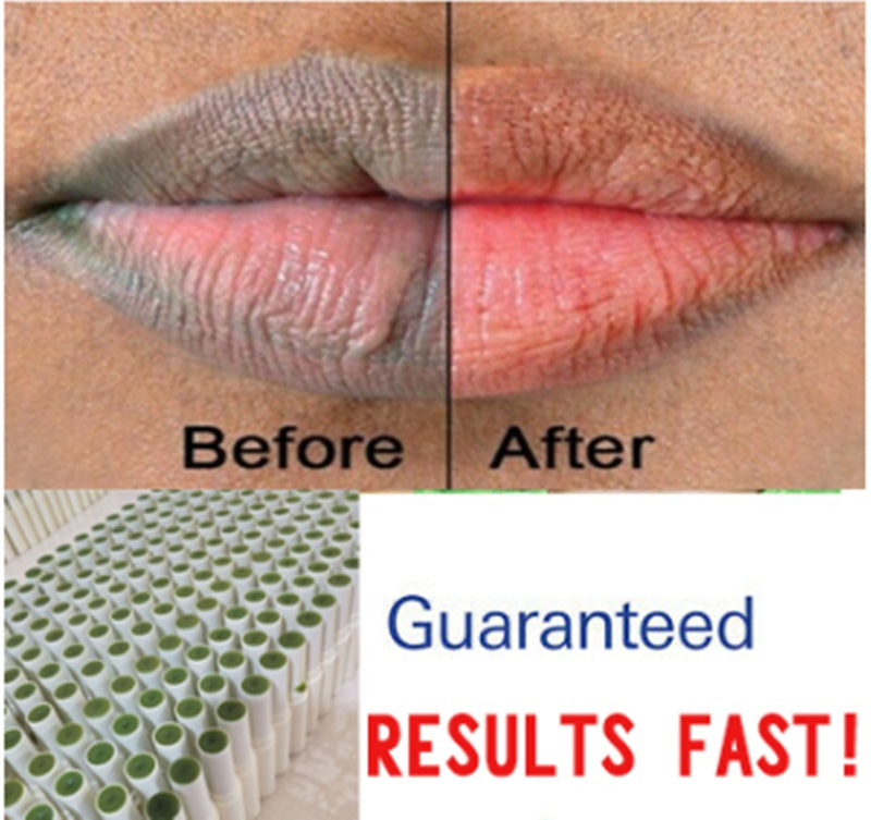 Soothing Green Lip Treatment