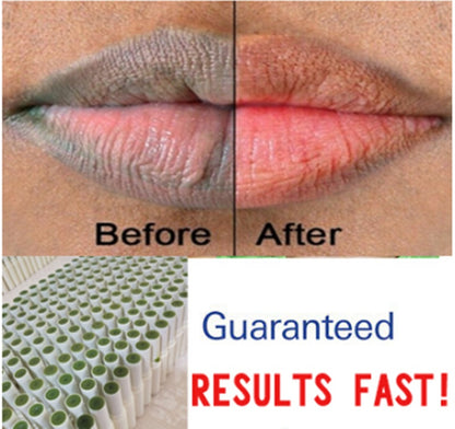 Soothing Green Lip Treatment